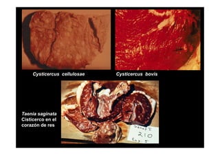 Cysticercus cellulosae

Taenia saginata
T
i
i t
Cisticerco en el
corazón de res

Cysticercus bovis

 