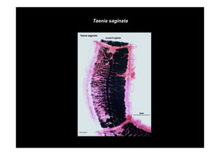 Taenia saginata

 
