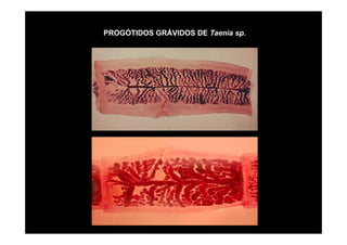 PROGÓTIDOS GRÁVIDOS DE Taenia sp.

 