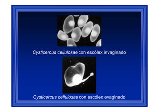 Cysticercus cellulosae con escólex invaginado

Cysticercus cellulosae con escólex evaginado

 