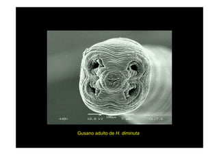 Gusano adulto de H. diminuta

 