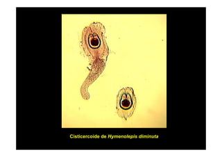 Cisticercoide de Hymenolepis diminuta

 