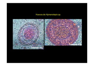 Huevos de Hymenolepis sp.

 