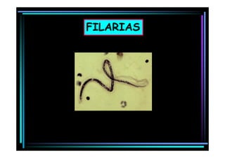 FILARIAS

 