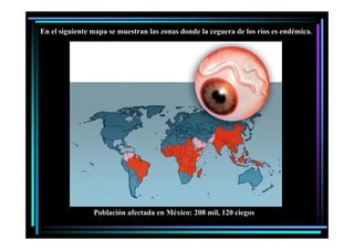 En el siguiente mapa se muestran las zonas donde la ceguera de los ríos es endémica.

Población f
P bl ió afectada en México: 208 mil, 120 ciegos
d
Mé i
il
i

 