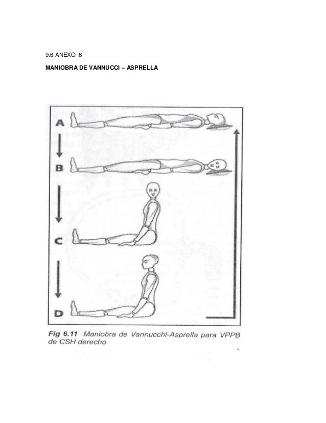GUIA DE PRACTICA CLINICA DE SINDROME VERTIGO GUIA DE PRACTICA CLINICA DE SINDROME VERTIGO