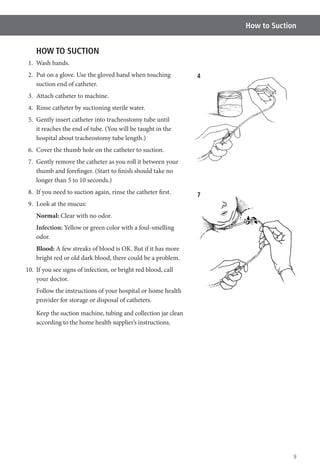 9
How to Suction
HOW TO SUCTION
1. Wash hands.
2. Put on a glove. Use the gloved hand when touching
suction end of catheter.
3. Attach catheter to machine.
4. Rinse catheter by suctioning sterile water.
5. Gently insert catheter into tracheostomy tube until
it reaches the end of tube. (You will be taught in the
hospital about tracheostomy tube length.)
6. Cover the thumb hole on the catheter to suction.
7. Gently remove the catheter as you roll it between your
thumb and forefinger. (Start to finish should take no
longer than 5 to 10 seconds.)
8. If you need to suction again, rinse the catheter first.
9. Look at the mucus:
Normal: Clear with no odor.
Infection: Yellow or green color with a foul-smelling
odor.
Blood:
bright red or old dark blood, there could be a problem.
10. If you see signs of infection, or bright red blood, call
your doctor.
Follow the instructions of your hospital or home health
provider for storage or disposal of catheters.
according to the home health supplier’s instructions.
4
7
 