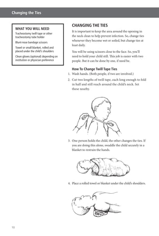 10
Changing the Ties
CHANGING THE TIES
It is important to keep the area around the opening in
the neck clean to help prevent infection. So, change ties
whenever they become wet or soiled, but change ties at
least daily.
You will be using scissors close to the face. So, you’ll
need to hold your child still. This job is easier with two
people. But it can be done by one, if need be.
How To Change Twill Tape Ties
1. Wash hands. (Both people, if two are involved.)
2. Cut two lengths of twill tape, each long enough to fold
in half and still reach around the child’s neck. Set
these nearby.
3. One person holds the child, the other changes the ties. If
you are doing this alone, swaddle the child securely in a
blanket to restrain the hands.
4. Place a rolled towel or blanket under the child’s shoulders.
WHAT YOU WILL NEED
Tracheostomy twill tape or other
tracheostomy tube holder
Blunt-nose bandage scissors
Towel or small blanket, rolled and
placed under the child’s shoulders
Clean gloves (optional) depending on
institution or physician preference
 