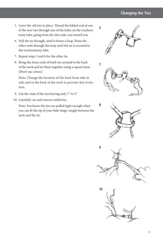 11
Changing the Ties
5. Leave the old ties in place. Thread the folded end of one
of the new ties through one of the holes on the tracheos-
tomy tube, going from the skin side, out toward you.
6. Pull the tie through, until it forms a loop. Draw the
other ends through the loop until the tie is secured to
the tracheostomy tube.
7. Repeat steps 5 and 6 for the other tie.
8. Bring the loose ends of both ties around to the back
of the neck and tie them together using a square knot.
(Don’t use a bow.)
Note: Change the location of the knot from side to
side and in the back of the neck to prevent skin irrita-
tion.
9. Cut the ends of the ties leaving only 1” to 2.”
10. Carefully cut and remove soiled ties.
Note: You know the ties are pulled tight enough when
you can fit the tip of your little finger snugly between the
neck and the tie.
8
9
10
7
5
 