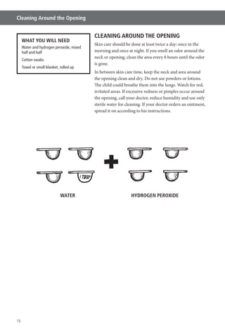 16
Cleaning Around the Opening
CLEANING AROUND THE OPENING
Skin care should be done at least twice a day: once in the
morning and once at night. If you smell an odor around the
neck or opening, clean the area every 8 hours until the odor
is gone.
In between skin care time, keep the neck and area around
the opening clean and dry. Do not use powders or lotions.
The child could breathe them into the lungs. Watch for red,
irritated areas. If excessive redness or pimples occur around
the opening, call your doctor, reduce humidity and use only
sterile water for cleaning. If your doctor orders an ointment,
spread it on according to his instructions.
WHAT YOU WILL NEED
Water and hydrogen peroxide, mixed
half and half
Cotton swabs
Towel or small blanket, rolled up
WATER HYDROGEN PEROXIDE
 
