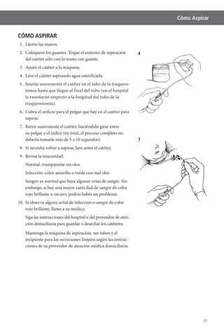 37
Cómo Aspirar
CÓMO ASPIRAR
1. Lávese las manos.
2. Colóquese los guantes. Toque el extremo de aspiración
del catéter sólo con la mano con guante.
3. Ajuste el catéter a la máquina.
4. Lave el catéter aspirando agua esterilizada.
5. Inserte suavemente el catéter en el tubo de la traqueos-
tomía hasta que llegue al final del tubo (en el hospital
le enseñarán respecto a la longitud del tubo de la
traqueostomía).
6. Cubra el orificio para el pulgar que hay en el catéter para
aspirar.
7. Retire suavemente el catéter, haciéndolo girar entre
su pulgar y el índice (en total, el proceso completo no
debería tomarle más de 5 a 10 segundos).
8. Si necesita volver a aspirar, lave antes el catéter.
9. Revise la mucosidad:
Normal: transparente sin olor.
Infección: color amarillo o verde con mal olor.
Sangre: es normal que haya algunas vetas de sangre. Sin
embargo, si hay una mayor canti dad de sangre de color
rojo brillante u oscuro, podría haber un problema.
10. Si observa alguna señal de infección o sangre de color
rojo brillante, llame a su médico.
Siga las instrucciones del hospital o del proveedor de aten-
ción domiciliaria para guardar o desechar los catéteres.
Mantenga la máquina de aspiración, sus tubos y el
recipiente para las secreciones limpios según las instruc-
ciones de su proveedor de atención médica domiciliaria.
4
7
 