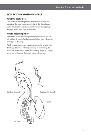 How the Tracheostomy Works
3
HOW THE TRACHEOSTOMY WORKS
What the Doctor Does
The doctor makes an opening (stoma) in the front of the
neck into the wind pipe (trachea). He or she then places a
curved plastic tube (tracheostomy tube) into this opening
through which your child will breathe.
What’s Happening Inside
Normally, we breathe through the nose and mouth so that
air is filtered, warmed and moistened before it goes down the
windpipe to the lungs.
With a tracheostomy, air goes directly into the windpipe to
the lungs. There’s no filtering, warming or moistening. You
will learn how to make up for this by using the proper equip-
ment and by learning the proper tracheostomy care.
Esophagus (to stomach)Windpipe (trachea)
Lungs
Air Sacs
 