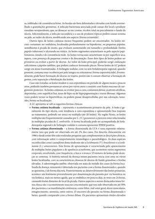 Guia de vigilância epidemiológica