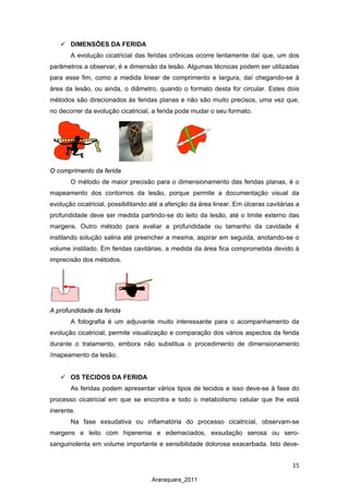 15
Araraquara_2011
 DIMENSÕES DA FERIDA
A evolução cicatricial das feridas crônicas ocorre lentamente daí que, um dos
parâmetros a observar, é a dimensão da lesão. Algumas técnicas podem ser utilizadas
para esse fim, como a medida linear de comprimento e largura, daí chegando-se à
área da lesão, ou ainda, o diâmetro, quando o formato desta for circular. Estes dois
métodos são direcionados às feridas planas e não são muito precisos, uma vez que,
no decorrer da evolução cicatricial, a ferida pode mudar o seu formato.
O comprimento da ferida
O método de maior precisão para o dimensionamento das feridas planas, é o
mapeamento dos contornos da lesão, porque permite a documentação visual da
evolução cicatricial, possibilitando até a aferição da área linear. Em úlceras cavitárias a
profundidade deve ser medida partindo-se do leito da lesão, até o limite externo das
margens. Outro método para avaliar a profundidade ou tamanho da cavidade é
instilando solução salina até preencher a mesma, aspirar em seguida, anotando-se o
volume instilado. Em feridas cavitárias, a medida da área fica comprometida devido à
imprecisão dos métodos.
A profundidade da ferida
A fotografia é um adjuvante muito interessante para o acompanhamento da
evolução cicatricial, permite visualização e comparação dos vários aspectos da ferida
durante o tratamento, embora não substitua o procedimento de dimensionamento
/mapeamento da lesão.
 OS TECIDOS DA FERIDA
As feridas podem apresentar vários tipos de tecidos e isso deve-se à fase do
processo cicatricial em que se encontra e todo o metabolismo celular que lhe está
inerente.
Na fase exsudativa ou inflamatória do processo cicatricial, observam-se
margens e leito com hiperemia e edemaciados, exsudação serosa ou sero-
sanguinolenta em volume importante e sensibilidade dolorosa exacerbada. Isto deve-
 