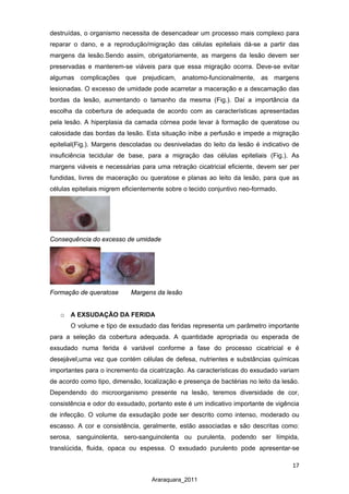 17
Araraquara_2011
destruídas, o organismo necessita de desencadear um processo mais complexo para
reparar o dano, e a reprodução/migração das células epiteliais dá-se a partir das
margens da lesão.Sendo assim, obrigatoriamente, as margens da lesão devem ser
preservadas e manterem-se viáveis para que essa migração ocorra. Deve-se evitar
algumas complicações que prejudicam, anatomo-funcionalmente, as margens
lesionadas. O excesso de umidade pode acarretar a maceração e a descamação das
bordas da lesão, aumentando o tamanho da mesma (Fig.). Daí a importância da
escolha da cobertura de adequada de acordo com as características apresentadas
pela lesão. A hiperplasia da camada córnea pode levar à formação de queratose ou
calosidade das bordas da lesão. Esta situação inibe a perfusão e impede a migração
epitelial(Fig.). Margens descoladas ou desniveladas do leito da lesão é indicativo de
insuficiência tecidular de base, para a migração das células epiteliais (Fig.). As
margens viáveis e necessárias para uma retração cicatricial eficiente, devem ser per
fundidas, livres de maceração ou queratose e planas ao leito da lesão, para que as
células epiteliais migrem eficientemente sobre o tecido conjuntivo neo-formado.
Consequência do excesso de umidade
Formação de queratose Margens da lesão
o A EXSUDAÇÃO DA FERIDA
O volume e tipo de exsudado das feridas representa um parâmetro importante
para a seleção da cobertura adequada. A quantidade apropriada ou esperada de
exsudado numa ferida é variável conforme a fase do processo cicatricial e é
desejável,uma vez que contém células de defesa, nutrientes e substâncias químicas
importantes para o incremento da cicatrização. As características do exsudado variam
de acordo como tipo, dimensão, localização e presença de bactérias no leito da lesão.
Dependendo do microorganismo presente na lesão, teremos diversidade de cor,
consistência e odor do exsudado, portanto este é um indicativo importante de vigência
de infecção. O volume da exsudação pode ser descrito como intenso, moderado ou
escasso. A cor e consistência, geralmente, estão associadas e são descritas como:
serosa, sanguinolenta, sero-sanguinolenta ou purulenta, podendo ser límpida,
translúcida, fluida, opaca ou espessa. O exsudado purulento pode apresentar-se
 