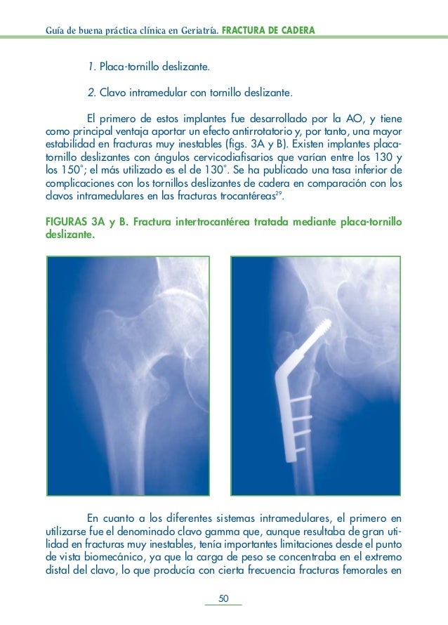 Guia fractura cadera Guia fractura cadera