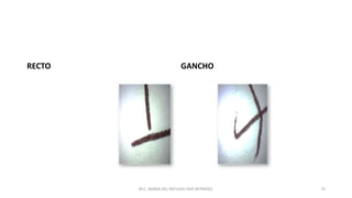 RECTO GANCHO
M.C. MARIA DEL REFUGIO HDZ REYNOSO. 73
 