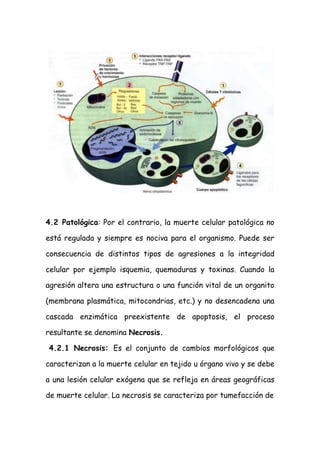 4.2 Patológica: Por el contrario, la muerte celular patológica no
está regulada y siempre es nociva para el organismo. Puede ser
consecuencia de distintos tipos de agresiones a la integridad
celular por ejemplo isquemia, quemaduras y toxinas. Cuando la
agresión altera una estructura o una función vital de un organito
(membrana plasmática, mitocondrias, etc.) y no desencadena una
cascada enzimática preexistente de apoptosis, el proceso
resultante se denomina Necrosis.
4.2.1 Necrosis: Es el conjunto de cambios morfológicos que
caracterizan a la muerte celular en tejido u órgano vivo y se debe
a una lesión celular exógena que se refleja en áreas geográficas
de muerte celular. La necrosis se caracteriza por tumefacción de
 