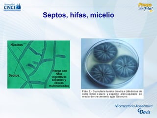 Septos, hifas, micelio
 