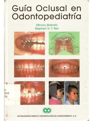 Guia oclusal en odontopediatria