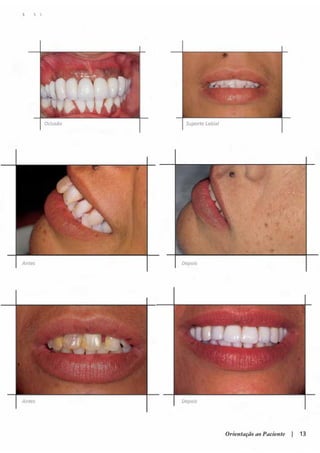 Guia orientacao implantes