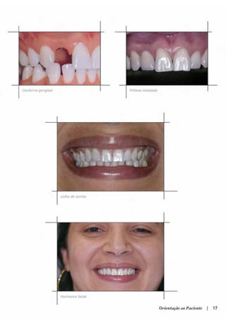 Guia orientacao implantes