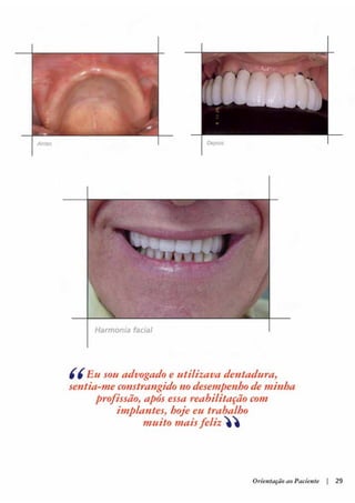 Guia orientacao implantes