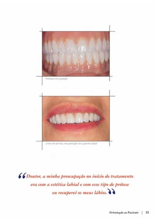 Guia orientacao implantes