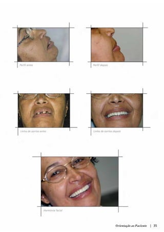 Guia orientacao implantes