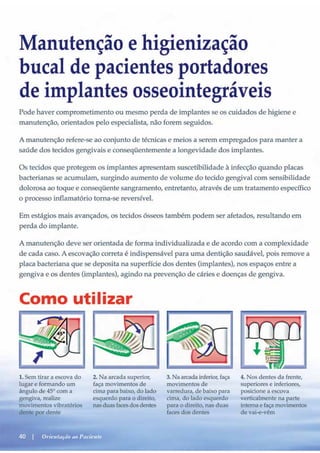 Guia orientacao implantes
