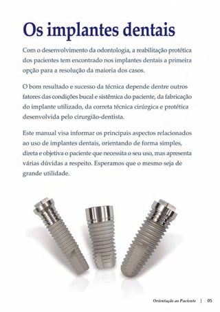 Guia orientacao implantes