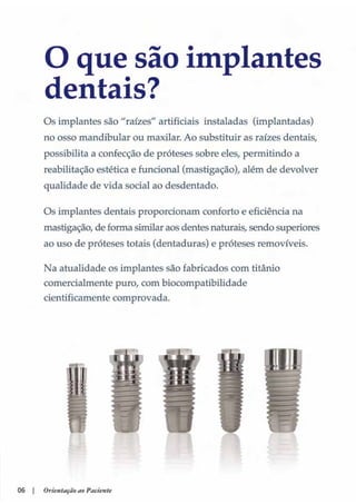 Guia orientacao implantes