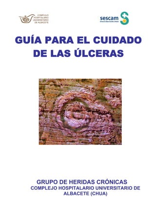 GUÍA PARA EL CUIDADO DE LAS ÚLCERAS 
GRUPO DE HERIDAS CRÓNICAS 
COMPLEJO HOSPITALARIO UNIVERSITARIO DE ALBACETE (CHUA)  