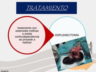 TRATAMIENTO 
ESPLENECTOMÍA 
tratamiento con 
esteroides ineficaz 
o exista 
corticodependencia 
se procede a 
realizar 
 