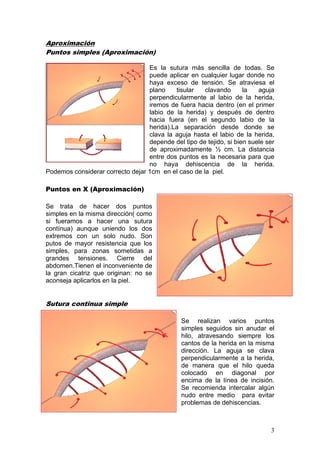 Aproximación
Puntos simples (Aproximación)

                                  Es la sutura más sencilla de todas. Se
                                  puede aplicar en cualquier lugar donde no
                                  haya exceso de tensión. Se atraviesa el
                                  plano    tisular   clavando       la   aguja
                                  perpendicularmente al labio de la herida,
                                  iremos de fuera hacia dentro (en el primer
                                  labio de la herida) y después de dentro
                                  hacia fuera (en el segundo labio de la
                                  herida).La separación desde donde se
                                  clava la aguja hasta el labio de la herida,
                                  depende del tipo de tejido, si bien suele ser
                                  de aproximadamente ½ cm. La distancia
                                  entre dos puntos es la necesaria para que
                                  no haya dehiscencia de la herida.
Podemos considerar correcto dejar 1cm en el caso de la piel.

Puntos en X (Aproximación)

Se trata de hacer dos puntos
simples en la misma dirección( como
si fueramos a hacer una sutura
contínua) aunque uniendo los dos
extremos con un solo nudo. Son
putos de mayor resistencia que los
simples, para zonas sometidas a
grandes tensiones. Cierre del
abdomen.Tienen el inconveniente de
la gran cicatriz que originan: no se
aconseja aplicarlos en la piel.


Sutura continua simple

                                              Se realizan varios puntos
                                              simples seguidos sin anudar el
                                              hilo, atravesando siempre los
                                              cantos de la herida en la misma
                                              dirección. La aguja se clava
                                              perpendicularmente a la herida,
                                              de manera que el hilo queda
                                              colocado en diagonal por
                                              encima de la línea de incisión.
                                              Se recomienda intercalar algún
                                              nudo entre medio para evitar
                                              problemas de dehiscencias.



                                                                             3
 