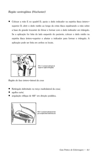Guia Prático de Enfermagem - 61
Região ventroglútea (Hochester)
 Colocar a mão E no quadril D, apoia o dedo indicador na espinha ilíaca ântero-
superior D, abrir o dedo médio ao longo da crista ilíaca espalmando a mão sobre
a base do grande trocanter do fêmur e formar com o dedo indicador um triângulo.
Se a aplicação for feita do lado esquerdo do paciente, colocar o dedo médio na
espinha ilíaca ântero-superior e afastar o indicador para formar o triângulo. A
aplicação pode ser feita em ambos os locais.
Região do face ântero-lateral da coxa
 Retângulo delimitado no terço mediolateral da coxa;
 agulha curta;
 angulação oblíqua de 45° em direção podálica.
 