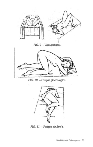 Guia Prático de Enfermagem - 78
 