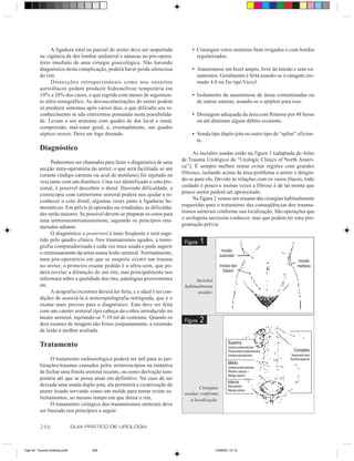 A ligadura total ou parcial do ureter deve ser suspeitada          • Conseguir cotos ureterais bem irrigados e com bordos
         na vigência de dor lombar unilateral e náuseas no pós-opera-              regularizados.
         tório imediato de uma cirurgia ginecológica. Não havendo
         diagnóstico desta complicação, poderá haver perda silenciosa            • Anastomose em bizel amplo, livre de tensão e sem va-
         do rim.                                                                   zamentos. Geralmente é feita usando-se o categute cro-
              Dissecções retroperitoneais como nos enxertos                        mado 4.0 ou fio tipo Vicryl.
         aortoilíacos podem produzir hidronefrose temporária em
         10% a 20% dos casos, e que regride com meses de seguimen-               • Isolamento da anastomose de áreas contaminadas ou
         to ultra-sonográfico. As desvascularizações do ureter podem               de outras suturas, usando-se o epíplon para isso.
         só produzir sintomas após vários dias, o que dificulta seu re-
         conhecimento se não estivermos pensando nesta possibilida-              • Drenagem adequada da área com Penrose por 48 horas
         de. Levam a um urinoma com quadro de dor local e renal,                   ou até diminuir algum débito existente.
         compressão, mal-estar geral, e, eventualmente, um quadro
         séptico severo. Deve ser logo drenado.                                  • Sonda tipo duplo-jota ou outro tipo de “splint” eficien-
                                                                                   te.
         Diagnóstico
                                                                                  As incisões usadas estão na figura 1 (adaptada do Atlas
              Poderemos ser chamados para fazer o diagnóstico de uma         de Trauma Urológico da “Urologic Clinics of North Ameri-
         secção intra-operatória do ureter, o que será facilitado se um      ca”). É sempre melhor tentar evitar regiões com grandes
         corante (índigo-carmim ou azul de metileno) for injetado na         fibroses, isolando acima da área-problema o ureter e dirigin-
         veia junto com um diurético. Uma vez identificado o coto pro-       do-se para ela. Devido às relações com os vasos ilíacos, todo
         ximal, é possível descobrir o distal. Havendo dificuldade, a        cuidado é pouco e muitas vezes a fibrose é de tal monta que
         cistoscopia com cateterismo ureteral poderá nos ajudar a re-        pouco ureter poderá ser aproveitado.
         conhecer o coto distal, algumas vezes junto a ligaduras he-              Na figura 2 vemos um resumo das cirurgias habitualmente
         mostáticas. Em pélvis já operadas ou irradiadas, as dificulda-      requeridas para o tratamento das conseqüências dos trauma-
         des serão maiores. Se possível devem-se preparar os cotos para      tismos ureterais conforme sua localização. São operações que
         uma ureteroureteroanastomose, seguindo os princípios enu-           o urologista necessita conhecer, mas que podem ter uma pro-
         merados adiante.                                                    gramação prévia.
              O diagnóstico a posteriori é mais freqüente e será suge-
         rido pelo quadro clínico. Nos traumatismos agudos, a tomo-           Figura   1
         grafia computadorizada é cada vez mais usada e pode sugerir
         o extravasamento da urina numa lesão ureteral. Normalmente,
         num pós-operatório em que se suspeite existir um trauma
         no ureter, o primeiro exame pedido é o ultra-som, que po-
         derá revelar a dilatação de um rim, mas principalmente nos
         informará sobre a qualidade dos rins, patologias preexistentes             Incisões
         etc.                                                                 habitualmente
              A urografia excretora deverá ser feita, e o ideal é ter con-           usadas.
         dições de associá-la à ureteropielografia retrógrada, que é o
         exame mais preciso para o diagnóstico. Esta deve ser feita
         com um cateter ureteral tipo cabeça-de-cobra introduzido no
         meato ureteral, injetando-se 7-10 ml de contraste. Quando os
         dois exames de imagem são feitos conjuntamente, a extensão
                                                                              Figura   2
         da lesão é melhor avaliada.

         Tratamento
               O tratamento endourológico poderá ser útil para as per-
         furações/traumas causados pelos ureteroscópios na tentativa
         de fechar uma fístula ureteral recente, ou como derivação tem-
         porária até que se possa atuar em definitivo. No caso de ser
         deixada uma sonda duplo-jota, ela permitirá a cicatrização do
                                                                                     Cirurgias
         ureter lesado servindo como um molde para tentar evitar es-          usadas conforme
         treitamentos, ao mesmo tempo em que drena o rim.                        a localização.
               O tratamento cirúrgico dos traumatismos ureterais deve
         ser baseado nos princípios a seguir:


         246                  GUIA PRÁTICO DE UROLOGIA



Cap 42- Trauma Ureteral.pm6         246                                                        13/06/00, 15:12
 