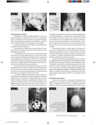 Figura   1                                                      Figura   2
                                                                                     Rotura
                Cistografia.
                                                                           extraperitoneal.
                     Rotura
                                                                                Cistografia
            extraperitoneal.
                                                                                     mostra
            Extravasamento
                                                                           extravasamento
              abundante de
                                                                                mínimo de
                  contraste
                                                                          contraste. Bexiga
                perivesical.
                                                                                 piriforme.


         Traumatismos fechados                                            fra-umbilical transperitoneal, onde a cavidade abdominal pode
              Geralmente as lesões da bexiga não põem em risco, de        ser inspecionada para a avaliação do comprometimento de
         maneira imediata, a vida do paciente. Por isso é importante      outros órgãos. Em casos excepcionais o acesso pode ser por
         que se considerem em primeiro lugar suas condições respira-      via extraperitoneal. Em qualquer das situações a bexiga é
         tórias e hemodinâmicas e também a possibilidade e a gravida-     aberta, o interior inspecionado e as lesões reparadas. A son-
         de do comprometimento concomitante de outros órgãos.             da de Foley deve permanecer por cerca de catorze dias e
              Em todas as situações é aconselhável a administração de     uma cistografia de controle deve ser realizada antes de sua
         antibióticos de amplo espectro.                                  retirada.
              Nas contusões, a conduta deve ser conservadora, com son-          Ultimamente passou-se a adotar apenas a drenagem ve-
         da de demora e eventual irrigação da bexiga, repouso e acom-     sical com a sonda de Foley em casos selecionados de rotura
         panhamento do paciente.                                          extraperitoneal (figura 4); nestes, a bexiga não deve ter urina
              A sonda também se justifica em casos de grandes hema-       infectada e coágulos que obstruam a sonda. O seguimento deve
         tomas perivesicais que podem distorcer o colo vesical e difi-    ser rigoroso, e qualquer evolução desfavorável justifica mu-
         cultar a micção; a drenagem do hematoma nesta situação não       dança de conduta para cirurgia reparadora.
         é aconselhada, pois normalmente é absorvido, e sua manipu-             Na rotura intraperitoneal a laceração geralmente é ampla, e
         lação pode resultar em sangramento abundante pelo destam-        a cirurgia imediata é recomendada. No caso de perfuração duran-
         ponamento e também pela possibilidade de contaminação e o        te procedimentos urológicos a conduta conservadora apenas com
         desenvolvimento de um abscesso secundário.                       a drenagem vesical pode ser adotada porque tende a ser mais
              Os princípios básicos do tratamento cirúrgico são o des-    restrita e acontece em situação em que o paciente está mais está-
         bridamento da área lesada e o fechamento da bexiga por pla-      vel. O acesso para a cirurgia é por laparotomia mediana infra-
         nos com fios absorvíveis, a derivação da urina através de son-   umbilical transperitoneal, quando as coleções líquidas são aspi-
         da vesical ou cistostomia (principalmente em crianças do sexo    radas e a cavidade abdominal lavada. As lesões que ocorrem du-
         masculino) e a drenagem do espaço perivesical.                   rante cirurgias laparoscópicas poderão ser corrigidas por esta
               A cirurgia é indicada na maioria dos casos de rotura ex-   mesma via.
         traperitoneal, principalmente se há necessidade de exploração
         cirúrgica de outros órgãos da cavidade abdominal. A recons-      Ferimentos penetrantes
         trução imediata é crítica para a manutenção da função vesical         Todos os casos devem ser explorados e reparados ime-
         quando a laceração envolve o colo vesical ou quando acom-        diatamente, pois é freqüente a lesão concomitante de outros
         panhada de trauma vaginal ou do reto. O acesso cirúrgico nas     órgãos. A bexiga deve ser aberta, e a urina proveniente dos
         lesões extraperitoneais é feito através de incisão mediana in-   meatos ureterais, examinada cuidadosamente. Se necessário,

           Figura   3                                                      Figura   4




                                                                               Cistografia de paciente
                Rotura intraperitoneal.                                    com rotura extraperitoneal,
              Na cistografia observa-se                                   que apresentou boa evolução
                      contraste livre na                                     apenas com cateterismo e
                  cavidade abdominal,                                                drenagem vesical
              entre as alças intestinais.                                       pelo prazo de 14 dias.


                                                                                        GUIA PRÁTICO DE UROLOGIA                     251


Cap 43- Trauma Vesical.pm6           251                                                  13/06/00, 15:13
 