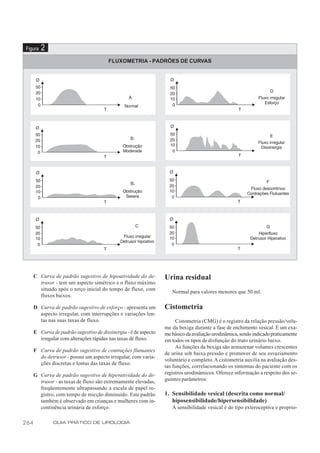 Figura   2
                                         FLUXOMETRIA - PADRÕES DE CURVAS




      C Curva de padrão sugestivo de hipoatividade do de-         Urina residual
        trusor - tem um aspecto simétrico e o fluxo máximo
        situado após o terço inicial do tempo de fluxo, com          Normal para valores menores que 50 ml.
        fluxos baixos.

      D Curva de padrão sugestivo de esforço - apresenta um       Cistometria
        aspecto irregular, com interrupções e variações len-
        tas nas suas taxas de fluxo.                                   Cistometria (CMG) é o registro da relação pressão/volu-
                                                                  me da bexiga durante a fase de enchimento vesical. É um exa-
      E Curva de padrão sugestivo de dissinergia - é de aspecto   me básico da avaliação urodinâmica, sendo indicado praticamente
        irregular com alterações rápidas nas taxas de fluxo.      em todos os tipos de disfunção do trato urinário baixo.
                                                                       As funções da bexiga são armazenar volumes crescentes
      F Curva de padrão sugestivo de contrações flutuantes
                                                                  de urina sob baixa pressão e promover de seu esvaziamento
        do detrusor - possui um aspecto irregular, com varia-
                                                                  voluntário e completo. A cistometria auxilia na avaliação des-
        ções discretas e lentas das taxas de fluxo.
                                                                  tas funções, correlacionando os sintomas do paciente com os
      G Curva de padrão sugestivo de hiperatividade do de-        registros urodinâmicos. Oferece informação a respeito dos se-
        trusor - as taxas de fluxo são extremamente elevadas,     guintes parâmetros:
        freqüentemente ultrapassando a escala de papel re-
        gistro, com tempo de micção diminuído. Este padrão        1. Sensibilidade vesical (descrita como normal/
        também é observado em crianças e mulheres com in-            hiposensibilidade/hipersensibilidade)
        continência urinária de esforço.                             A sensibilidade vesical é do tipo exteroceptiva e proprio-

264            GUIA PRÁTICO DE UROLOGIA
 