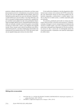 posterior a ablação endoscópica da válvula deve ser feita o mais          O rim multicístico displásico é um dos diagnósticos dife-
precocemente possível, eventualmente já na primeira semana          renciais mais comuns com a estenose da JUP. Se existe infec-
de vida. Nos casos de duplicidade do trato urinário, observa-se     ção, dor, hipertensão arterial ou uma massa palpável de di-
hidronefrose polar superior nos casos de obstrução e hidronefro-    mensões exageradas, a nefrectomia é a melhor opção. Caso
se polar inferior nos casos de refluxo. Caso haja obstrução, esta   não se observem os dados acima, a conduta expectante pode
deve-se em geral à ectopia ureteral ou ureterocele, e quando che-   ser instituída.
ga a produzir massa palpável já não existe parênquima funcio-             No urinoma, geralmente provocado na criança por obs-
nante na unidade superior do rim. A heminefroureterectomia deve     trução infravesical por válvula de uretra posterior, a antibioti-
então ser realizada, existindo controvérsia quanto a necessidade    coterapia, drenagem vesical e programação de tratamento da
ou não de se retirar todo o ureter, o que obrigaria uma segunda     válvula é a melhor opção. Caso não se disponha de material
incisão. Parece sensato assim realizar inicialmente uma nefrou-     endoscópico adequado para fulguração da válvula nos primei-
reterectomia parcial e, caso haja complicações relacionadas com     ros meses de vida, o acesso por via anterógrada através de
a presença do coto ureteral (ocorre em 15-20% dos casos), reali-    cistostomia permite o tratamento com material endoscópico
zar um segundo tempo para exérese do ureter distal.                 de calibre maior.




Bibliografia recomendada


                           1.      MACEDO JR A. In: CINTRA DO PRADO F RAMOS J, ROTHSCHILD H. Atualização terapêutica. 17.
                                                                            ,
                                     edição, São Paulo, 1997; 1079-83.
                           2.      THÜROFF J. Differential diagnostische. Stuttgart, 1996; 245-62.


316           GUIA PRÁTICO DE UROLOGIA
 