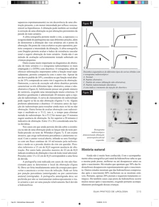 sapareceu espontaneamente) ou em decorrência de uma obs-
          trução presente, e em menor intensidade por refluxo vesicou-
                                                                               Figura   4
          reteral ou hiperdiurese. A dilatação pode também ser residual
          à correção de uma obstrução ou por alterações persistentes da
          parede do trato urinário.
               A ultra-sonografia permite medir o rim, a espessura e a
          ecogenicidade do parênquima nas suas diferentes porções, além
          de demonstrar a dilatação das vias urinárias até o ponto da
          obstrução. Do ponto de vista evolutivo ou pós-operatório, per-
          mite comparar a intensidade da dilatação. A ultra-sonografia
          com Doppler permite avaliar o índice de resistência vascular
          renal e sugerir obstrução do trato urinário. Ainda não é um
          método de avaliação suficientemente testado sobretudo em
          crianças pequenas.
               Outro exame muito importante no diagnóstico de obstru-
          ção do trato urinário é o renograma radioisotópico (o mais
          empregado é o DTPA) com diurético. O renograma, além de
          oferecer informações importantes sobre a função renal sepa-          Desenhos esquemáticos de diferentes tipos de curvas obtidas com
          radamente, permite compará-la com o outro rim. Apesar de             o renograma radioisotópico:
          um desvio padrão de 10%, considera-se que função renal abai-         A. Normal,
          xo de 35% comparada ao outro rim é sugestiva de obstrução.           B. Padrão obstrutivo,
                                                                               C. Padrão de estase (dilatação não-obstrutiva),
          Outrossim, a curva de excreção sob efeito diurético permite
                                                                               D. Padrão indeterminado (duvidoso).
          caracterizar os três diferentes tipos: obstrutivo, estase e não-
                                                                               A seta indica o momento da injeção do diurético.
          obstrutivo (figura 4). Infelizmente possui um grande número
          de variáveis, exigindo uma interpretação muito criteriosa. O         Figura   5
          diurético geralmente é administrado 20 minutos após a inje-
          ção de radioisótopo. A curva de clareamento do radioisótopo
          pode sugerir se há ou não obstrução (figuras 5 e 6). Alguns
          preferem administrar o diurético 15 minutos antes da inje-
          ção do radioisótopo para ressaltar ainda mais se há ou não
          obstrução. Outra forma de avaliar obstrução com radioisó-
          topo é medindo-se o T1/2, isto é, o tempo para eliminar
          metade do radioisótopo. Se o T1/2 for menor que 15 minutos
          sugere ausência de obstrução. Se for superior a 20 minutos é
          indicativo de obstrução. Entre 15 e 20 é considerada uma fai-
          xa duvidosa.
               Nos casos em que ainda persiste dúvida sobre a existên-
          cia ou não de uma obstrução pode-se lançar mão do teste per-                    Renograma
          fusão-pressão ou teste de Whitaker (figura 7). É um exame                    radioisotópico
          invasivo, que exige nefrostomia percutânea e cateterismo ve-         demonstrando dilatação
          sical. Com o cateter vesical aberto, infunde-se soro fisiológi-         ureteropielocalicial
                                                                                            esquerda.
          co com um fluxo contínuo de 10 ml/minuto pela nefrosto-
          mia e mede-se a pressão dentro do rim em questão. Pres-
          sões inferiores a 15 cm de H 2O sugerem ausência de obs-
          trução. Por outro lado, pressões maiores de 22 cm de H2O            História natural
          indicam existência de obstrução e risco de lesão renal adicional.
          Pressões entre 15 e 22 cm de H2O correspondem a uma faixa                Ainda não é muito bem conhecida. Com o acompanha-
          de dúvida.                                                          mento ultra-sonográfico pré-natal da hidronefrose sabe-se que
               A pielografia está indicada em casos de rim não-fun-           a mesma pode piorar, melhorar ou até desaparecer antes ou
          cionante para se determinar o local da obstrução (figura            após o nascimento. Há estudos que apontam que 50% das hi-
          8). Deve ser feita imediatamente antes da cirurgia para apro-       dronefroses desaparecem espontaneamente após o nascimen-
          veitar a anestesia e evitar risco de infecção. Pode ser feita       to. Outros estudos mostram que das hidronefroses comprova-
          por punção percutânea (anterógrada) ou por cateterismo              das após o nascimento 80% melhoram ou se mostram está-
          ureteral (retrógrada). A pielografia anterógrada deve ser           veis. Portanto, apenas 20% pioram e requerem tratamento ci-
          preferida por não se instrumentar endoscopicamente o tra-           rúrgico. Há também casos cuja piora da hidronefrose ocorre
          to urinário e por ser uma punção relativamente fácil devido         muitos meses após o nascimento, exigindo portanto acompa-
          a hidronefrose.                                                     nhamento prolongado dessas crianças.

                                                                                            GUIA PRÁTICO DE UROLOGIA                     319


Cap 54 - Hidronefrose Infancia.pm6   319                                                      13/06/00, 15:15
 