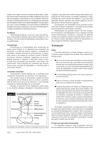 tende-se até a região coronal. O restante da uretra distal, a glan-      congênita, o que pode levar o bebê a choque hipovolêmico por
dar, forma-se pela canalização do cordão ectodérmico que cresce          perda de sal. Nesta situação, a avaliação citogenética e endo-
através da glande, comunicando-se com os folhetos uretrais fu-           crinológia do recém-nascido tem urgência. A paciente pode
sionados.A tubularização uretral ou a canalização em nível glan-         apresentar hérnias inguinais com ovários palpáveis que po-
dar incompleta resultam em um pênis hipospádico. Na maior parte          dem parecer simular testículos inguinais.
dos casos a causa é idiopática e em uma minoria se identificam                Em pacientes com hipospádia severa (escrotal ou peri-
distúrbios hormonais responsáveis por uma masculinização in-             neal) uma avaliação citogenética é aconselhável para afastar
completa da genitália ou alterações genéticas.                           possível anomalia cromossômica associada.
                                                                              Malformações do aparelho urinário são mais freqüen-
Incidência                                                               tes em pacientes com hipospádia severa e naqueles que têm
     Malformação freqüente, ocorre em 1 para cada 300 me-                outras malformações sistêmicas. Avaliação do aparelho
ninos. Uma tendência familiar sugere fatores poligênicos: 8%             urinário com ecografia encontra indicação apenas nestes ca-
dos pais e 14% dos irmãos de hipospádicos apresentam a mes-              sos. Outros exames radiológicos podem ser necessários se a
ma malformação.                                                          ultra-sonografia identificar alguma anomalia.

Classificação                                                            Tratamento
      Classificam-se as hipospádias pela localização do
meato uretral (figura 3). É importante para anotações em
                                                                         Idade
prontuário a escolha da técnica cirúrgica e avaliação dos
                                                                               O período ideal para a correção cirúrgica é entre os 6 e
resultados. Quando utilizada no pré-operatório é impor-
                                                                         12 meses ou após os quatro anos de idade. Estes números jus-
tante anotar a severidade da curvatura ventral (“chordee”
                                                                         tificam-se por:
inexistente, discreto, moderado, importante ou severo).
Quando removido o “chordee” e retificado o pênis, o mea-
                                                                             n Os níveis de testosterona encontram-se mais elevados
to pode ficar em posição mais proximal, o que muda a sua
                                                                               até os seis meses de vida, o que induz a um crescimento
classificação. Para avaliação dos resultados das diversas
                                                                               peniano que vem a facilitar tecnicamente a cirurgia. Após
técnicas para correção de hipospádia se classifica após a
                                                                               os seis meses, os níveis de testosterona permanecem mí-
retif icação peniana.
                                                                               nimos até a puberdade e só então o pênis volta a retomar
                                                                               um desenvolvimento acelerado.
Anomalias associadas
     Criptorquidia e hérnia inguinal são as anomalias mais                   n A imaturidade pulmonar até os seis meses aumenta o
comumente encontradas em pacientes com hipospádia.                             risco da anestesia.
     Em qualquer grau de hipospádia, quando presente
criptorquidia uni ou bilateral, deve-se excluir a possibili-                 n Entre os 18 meses e 4 anos de idade a cirurgia peniana
dade de tratar-se de um caso de intersexo, e uma avaliação                     pode levar ao complexo de castração.
citogenética e endocrinológica faz-se necessária.
     Quando os testículos forem impalpáveis, pode tratar-                    n O manejo do paciente com relação aos cuidados pós-ope-
se de genitália ambígua conseqüente à hiperplasia adrenal                      ratórios entre um ano e quatro anos é mais complexo. Até
                                                                               um ano o paciente parece não inteirar-se do trauma a que
                                                                               foi submetido. De 1 ano a 18 meses já se movimenta mui-
  Figura   3   CLASSIFICAÇÃO DAS HIPOSPÁDIAS                                   to e dificulta a realização de curativos e cuidados com
                                                                               sonda. Entre 18 meses e 4 anos, vivencia conscientemen-
                                                                               te o processo e não o entende, rebelando-se. Após os qua-
                                                                               tro anos, entende a necessidade do procedimento e torna-
                                                                               se cooperativo.

                                                                              No entanto, tecnicamente, a cirurgia antes dos 12 meses
                                              Médio-peniano              de idade exige especialização, muita experiência e assiduidade
                                                                         na correção da patologia pelo cirurgião. Faz-se necessário o
                                             Peniana proximal ou         uso de magnificação ótica e material cirúrgico especializado,
                                             peno-escrotal               além de estrutura hospitalar adequada. Não se dispondo dos
                                                                         requisitos acima, pode ser aconselhável postergar a correção
                                                                         para após os quatro anos de idade.

                                                                         Preparo pré-operatório da genitália
                                                                              Os resultados cirúrgicos estão diretamente relaciona-
Classificação das hipospádias conforme a localização do meato uretral.   dos às condições técnicas do caso. Para melhorar estas condi-


352            GUIA PRÁTICO DE UROLOGIA
 