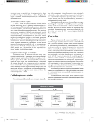 riormente, como em geral é feita. A vantagem teórica deste         tos, 16 F, é deixado por 14 dias. Procede-se a uma uretrografia
          procedimento é que o enxerto fixa-se à túnica albugínea dos        miccional e avalia-se possível extravasamento. Antibióticos
          corpos cavernosos, minimizando sua retração e facilitando a        são administrados enquanto os pacientes estão sondados, e
          neovascularização.                                                 cultura de urina com teste de sensibilidade aos antibióticos é
                                                                             obtida após a retirada da sonda.
          Fratura pélvica e lesão uretral                                          Caso o paciente não apresente sintomatologia, uretrogra-
                A uretra é lesada em cerca de 10% dos casos de fratura       fia retrógrada é realizada em 6 e 12 meses após o procedi-
          pélvica. Se o defeito uretral é pequeno, uma anastomose ure-       mento. Se não for esclarecedora, a uretra é avaliada com cis-
          tral por via perineal é curativa. Contudo, nos casos de defeitos   toscopia. A utilização de fluxo urinário no seguimento pós-
          severos e complexos, uma abordagem abdominoperineal é de           operatório não parece ter valor porque uma redução do cali-
          valia. Pubectomia total raramente é necessária. Nos casos em       bre uretral para menos de 10 F é necessária para redução do
          que o acesso retropúbico é difícil, uma pubectomia parcial         fluxo urinário.
          inferior facilita o procedimento. É importante drenar todo e
          qualquer hematoma existente para evitar que ocorra fibrose
          periuretral e conseqüente estenose. A presença do hematoma
                                                                             Conclusões
          pode, também por fibrose, danificar o mecanismo esfinctérico
                                                                                   Apesar do tratamento da estenose uretral dever ser indi-
          do colo vesical. Nos casos de lesões pequenas do colo vesical,
          alguns pacientes permanecem continentes. Por isto, nestes          vidualizado por causa das diversas nuances e variedades com
          casos, preferimos a reconstrução do colo em um segundo es-         que a doença se apresenta, algumas linhas gerais de tratamen-
          tágio, após a avaliação da continência. Nos casos de inconti-      to podem ser determinadas (veja esquema a seguir). Esteno-
          nência, mesmo após a reconstrução do colo, implante de es-         ses de uretra podem ser tratadas inicialmente com uretrotomia
          fíncter urinário artificial é uma opção.                           interna ou uretroplastia, sabendo-se que estenoses maiores que
                                                                             1 cm e com esponjofibroses profundas têm resultados muito
          Complicações da cirurgia reconstrutiva                             baixos com o tratamento endoscópico. Neste caso, a uroplastia
                Reestenose ocorre em menos de 10% dos casos. A re-           por substituição é preferida. Optando-se por uretroplastia, ex-
          construção com excisão e anastomose tem resultado durável,         cisão da lesão e anastomose uretral são preferidas quando a
          enquanto aqueles que são submetidos à reconstrução por subs-       estenose é menor que 1 cm. As reestenoses pós-uretrotomias
          tituição, apesar de um índice de sucesso de 95% em um ano,         internas devem ser tratadas com uretroplastia, enquanto aque-
          podem no futuro cursar com reestenose uretral. Reestenoses         las pós-uretroplastias podem ser tratadas tanto com uretroto-
          são tratadas de acordo com os mesmos princípios de uma es-         mia interna quanto por uma nova cirurgia. As estenoses que ocor-
          tenose primária. Em mãos experientes, impotência e inconti-        rem após hipospádias são tratadas inicialmente com dilatação,
          nência raramente resultam do procedimento cirúrgico, mas sim       seguidas de cirurgias nos casos de recidivas.
          da extensão da fratura, por lesão das artérias pudendas bilate-          As estenoses pós-prostatectomia radical respondem bem ao
          rais e/ou dos nervos erigentes, assim como por lesão dos           tratamento com dilatações (sob visão endoscópica), reservando-
          esfíncteres proximal e distal.                                     se a uretrotomia interna ou ressecção da anastomose para os ca-
                                                                             sos mais severos.
          Cuidados pós-operatórios                                                 Excepcionalmente, uma cirurgia aberta com ressecção da
                                                                             estenose e reanastomose uretrovesical pode estar indicada, na falha
                 Um cateter uretral fenestrado para drenagem de exsuda-      dos outros procedimentos.




                                                                                          GUIA PRÁTICO DE UROLOGIA                          89


Cap 16 - Estenose uretral.pm6      89                                                        13/06/00, 13:14
 