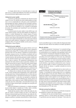 A cirurgia aberta deve ser reservada para os casos em
que a Leco e a endoscopia falharam. Há ainda a possibilidade
                                                                    Figura   3       TIPOS DE CESTAS OU
                                                                                     SONDAS DE DORMIA
da ureterolitotomia laparoscópica nesses casos.

Cálculo do ureter médio                                                                                    Ponta flexível
     A primeira escolha para o tratamento do cálculo do ureter                           Cesta com três fios
médio é a Leco. Os cálculos do ureter médio podem ser trata-
dos in situ ou empurrados de volta para o rim (“push-back”)
pela passagem de cateter e injeção de soro fisiológico sob pres-
são. Se a máquina utilizada permitir a localização destes cál-
culos, eles devem ser tratados in situ, evitando-se a passagem
de cateter. Os resultados com “push-back” ou in situ são mui-                           Cesta com cinco fios
to semelhantes.
     A ureteroscopia do ureter médio é mais difícil que a do
ureter inferior porque, além das dificuldades de ultrapassar o
meato e o ureter intramural, há o trajeto sinuoso. O ureter
intramural está em sua posição mais posterior e quando cruza                             Cesta com seis fios
com os vasos ilíacos está na posição mais anterior. Os instru-      O número de fios dispostos helicoidalmente é variável,
mentos semi-rígidos introduzidos no ureter precisam retificar       podendo ter ou não a ponta flexível.
estas curvas para subirem e atingirem o ureter lombar. A in-
trodução sobre o fio guia de trabalho auxilia muito, evitando
perfurações e falsos trajetos.                                     sível é aconselhável que se evitem ondas de choque para tratar
                                                                   cálculos do ureter inferior de mulheres em idade reprodutiva.
Cálculo do ureter inferior
      O tratamento dos cálculos do ureter inferior com Leco        Rua de cálculos
tem sucesso em aproximadamente 80% dos casos, enquanto a                Também chamada de “steinstrasse”, é o acúmulo de frag-
ureteroscopia atinge 98%. O tempo médio necessário para o          mentos de cálculos no ureter pós-Leco. Os pacientes podem
paciente estar livre de cálculo é imediato na ureteroscopia e      ser assintomáticos ou se comportar como quaisquer outros com
de quatro semanas na Leco. Os melhores resultados da Leco          cálculo ureteral. O tratamento depende da situação clínica.
são nos cálculos menores que 5 mm. A Leco tem menor custo,              Pacientes assintomáticos podem ser observados e mo-
é menos invasiva, não necessita anestesia, sendo a melhor op-      nitorados com raio X simples ou ultra-som. Se a obstrução
ção nos cálculos menores que 5 mm, enquanto a ureterosco-          for significante, com hidronefrose ou dor de difícil contro-
pia o é para os maiores. Os tratamentos ambulatoriais sem          le, o tratamento deve ser intervencionista. Quando não há
anestesia são muito atrativos para os pacientes. Embora o ín-      infecção, a primeira opção é a reaplicação da Leco sobre a
dice de sucesso da Leco para o cálculo do ureter distal chegue     rua de cálculos, o que resolve a maioria dos casos. A passa-
a 80%, a taxa de retratamento vai de 30% a 50%, e apenas a         gem de cateter duplo J é difícil e geralmente provoca per-
metade dos pacientes elimina completamente o cálculo em duas       furação devido ao edema e à grande extensão da rua de
semanas. Os fragmentos de cálculo pós-Leco continuam um            cálculos no ureter.
problema, podendo levar a obstrução, hidronefrose e sepse.              Nos casos em que a reaplicação da Leco não resolve ou
      As chances de os cálculos do ureter distal, menores que      quando há infecção associada, a ureteroscopia é uma ótima
6 mm, serem retirados pela manipulação com sonda de Dor-           conduta. A introdução do ureteroscópio deve ser cuidadosa,
mia são muito boas. Este procedimento deve ser feito sob con-      pois não há espaço na luz do ureter. Muitas vezes o fluxo de
trole de fluoroscopia e visão direta do meato por via endoscó-     líquido de irrigação ou a litotripsia intracorpórea deslocam os
pica (cistoscópio). A cesta deve ser passada no máximo de          fragmentos para o ureter superior ou de volta para o rim. Os
três a quatro vezes – número arbitrário que, porém, parece ser     fragmentos podem ser retirados com cesta de Dormia sob vi-
seguro para evitar trauma ao ureter. Minha preferência é por       são direta, devendo-se evitar a passagem da cesta fora do campo
cestas de cinco fios, helicoidais, com ponta flexível que evita    de visão, uma vez que as perfurações são muito comuns. Quan-
a perda do trajeto ureteral após a passagem da cesta pelo cál-     do nenhum outro método resolve a obstrução, a colocação de
culo (figura 3).                                                   nefrostomia percutânea descomprime o ureter e os cálculos
      Outra possibilidade de tratamento é a simples passagem       são eliminados em 70% das vezes.
de um cateter duplo J, mantido por 14 dias. Após a retirada,
80% dos cálculos são expelidos espontaneamente.                    Cálculo ureteral na infância
      Ainda não há consenso sobre o efeito das ondas de cho-            A Leco, com os novos litotritores, é eficiente em pacien-
que nos ovários. Existem estudos em ratos e um estudo em           tes pediátricos e parece não causar seqüelas.
humanos demonstrando que não há efeitos das ondas de cho-               Crianças até seis anos de idade fazem o tratamento sob
que sobre as gônadas, mas são estudos experimentais ou com         anestesia; entre 6 e 14 anos fazem sob sedação, e acima dos
pequena casuística e, portanto, não-definitivos. Dentro do pos-    15 geralmente precisam apenas de diazepan 1 hora antes do


108           GUIA PRÁTICO DE UROLOGIA
 