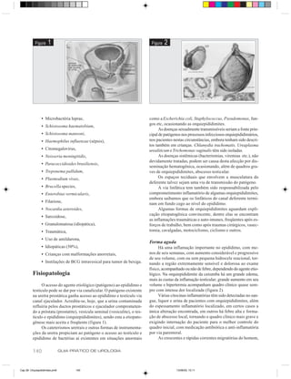 Figura    1                                                         Figura   2




                • Microbactéria leprae,                                       como a Escherichia coli, Staphylococcus, Pseudomonas, fun-
                                                                              gos etc, ocasionando as orquiepididimites.
                • Schistosoma haematobium,
                                                                                    As doenças sexualmente transmissíveis seriam a fonte prin-
                • Schistosoma mansoni,                                        cipal de patógenos nos processos infecciosos orquiepididimários,
                • Haemophilus influenzae (sépsis),                            nos pacientes nestas circunstâncias, embora tenham sido descri-
                                                                              tos também em crianças. Chlamydia trachomatis, Ureaplasma
                • Citomegalovírus,                                            urealiticum e Trichomonas vaginalis têm sido isoladas.
                • Neisseria meningitidis,                                           As doenças sistêmicas (bacteriemias, viremias etc.), não
                                                                              devidamente tratadas, podem ser causa desta afecção por dis-
                • Paracoccidioides brasiliensis,
                                                                              seminação hematogênica, ocasionando, além de quadros gra-
                • Treponema pallidum,                                         ves de orquiepididimites, abscesso testicular.
                • Plasmodium vivax,                                                 Os espaços teciduais que envolvem a musculatura do
                                                                              deferente talvez sejam uma via de transmissão do patógeno.
                • Brucella species,                                                 A via linfática tem também sido responsabilizada pelo
                • Enterobius vermicularis,                                    comprometimento inflamatório de algumas orquiepididimites,
                                                                              embora saibamos que os linfáticos do canal deferente termi-
                • Filariose,                                                  nam em fundo cego ao nível do epidídimo.
                • Nocardia asteroides,                                              Algumas formas de orquiepididimites aguardam expli-
                                                                              cação etiopatogênica convincente, dentre elas se encontram
                • Sarcoidose,
                                                                              as inflamações traumáticas e auto-imunes, freqüentes após es-
                • Granulomatosa (idiopática),                                 forços de trabalho, bem como após traumas cirúrgicos, vasec-
                • Traumática,                                                 tomia, cavalgadas, motociclismo, ciclismo e outros.

                • Uso de amildarona,
                                                                              Forma aguda
                • Idiopáticas (50%),                                                Há uma inflamação importante no epidídimo, com me-
                • Crianças com malformações anorretais,                       nos de seis semanas, com aumento considerável e progressivo
                                                                              de seu volume, com ou sem pequena hidrocele reacional, tor-
                • Instilações de BCG intravesical para tumor de bexiga.       nando a região extremamente sensível e dolorosa ao exame
                                                                              físico, acompanhado ou não de febre, dependendo do agente etio-
          Fisiopatologia                                                      lógico. Na orquiepididimite da caxumba há um grande edema,
                                                                              mais às custas da inflamação testicular; grande aumento em seu
                O acesso do agente etiológico (patógeno) ao epidídimo e       volume e hipertermia acompanham quadro clínico quase sem-
          testículo pode se dar por via canalicular. O patógeno existente     pre com intensa dor localizada (figura 2).
          na uretra prostática ganha acesso ao epidídimo e testículo via            Várias citocinas inflamatórias têm sido detectadas no san-
          canal ejaculador. Acredita-se, hoje, que a urina contaminada        gue, liquor e urina de pacientes com orquiepididimites, além
          refluiria pelos ductos prostáticos e ejaculador comprometen-        do espessamento inflamatório localizado, em certos casos a
          do a próstata (prostatite), vesícula seminal (vesiculite), o tes-   única alteração encontrada, em outros há febre alta e forma-
          tículo e epidídimo (orquiepididimites), sendo esta a etiopato-      ção de abscesso local, tornando o quadro clínico mais grave e
          gênese mais aceita e freqüente (figura 1).                          exigindo internação do paciente para o melhor controle do
                Os cateterismos uretrais e outras formas de instrumenta-      quadro inicial, com medicação antibiótica e anti-inflamatória
          ções da uretra propiciam ao patógeno o acesso ao testículo e        por via parenteral.
          epidídimo de bactérias aí existentes em situações anormais                As crescentes e rápidas correntes migratórias do homem,


          140                   GUIA PRÁTICO DE UROLOGIA



Cap 26- Orquiepididimites.pm6         140                                                    13/06/00, 15:11
 
