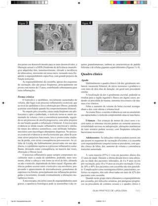 Figura    3                                                         Figura   4




          dos países em desenvolvimento para os mais desenvolvidos, a         quites granulomatosas, embora as características de padrão
          liberação sexual e a AIDS (Síndrome de deficiência imunoló-         folicular e de células gigantes sejam diferentes (figuras 3 e 4).
          gica adquirida) têm, lamentavelmente, elevado a incidência
          da tuberculose, mormente em nosso meio, tornando mais fre-
          qüente a orquiepididimite específica, com grande prejuízo da
                                                                              Quadro clínico
          função testicular.
                                                                              Aguda
               As orquiepididimites da caxumba, apesar dos esquemas
                                                                                   Habitualmente o quadro clínico é de dor, geralmente uni-
          de vacinação, não são pouco freqüentes, principalmente em
                                                                              lateral, raramente bilateral, de início insinuoso e gradativo e
          jovens com menos de 15 anos, contribuindo sobremaneira para
                                                                              com mais de dois dias de duração, em geral sem precedente
          estas inflamações.
                                                                              similar.
                                                                                   A localização da dor é geralmente escrotal, podendo se
          Forma crônica                                                       irradiar para a região inguinal e flanco em alguns casos, po-
               O testículo e o epidídimo, inicialmente aumentados de          dendo vir precedida de trauma, sintomas miccionais e de náu-
          volume, dão lugar a um processo inflamatório cicatricial, que       seas e/ou vômitos.
          ao nível do epidídimo o leva à obstrução por fibrose, podendo            Febre e aumento de volume da bolsa escrotal acompa-
          acarretar esterilidade quando há comprometimento bilateral.         nham a dor, com edema e eritema local.
               Na orquite pós-caxumba, causa ainda freqüente em ado-               Ao exame físico, o escroto evidencia-se com as característi-
          lescentes e após a puberdade, o testículo torna-se muito au-        cas supracitadas e o testículo comprometido situa-se mais baixo.
          mentado de volume e tem a consistência aumentada, seguin-
          do-se um processo de atrofia progressiva, com sério prejuízo              Crianças - Em crianças de menos de cinco anos e re-
          de sua função quando a inflamação é bilateral. À microscopia        cém-natos os sintomas iniciais podem ser somente anorexia,
          evidencia-se nítida reação inflamatória intersticial e edema,       irritabilidade nervosa ou indisposição; alterações anatômicas
          há rutura dos túbulos seminíferos, com infiltrado linfoplas-        de trato urinário podem ocorrer, com freqüentes infecções
          mocitário com macrófagos abundantes dispersos. No proces-           bacterianas recorrentes.
          so cicatricial evidencia-se atrofia testicular que, além de acar-
          retar sérios prejuízos funcionais, leva o jovem a uma síndro-             Adolescentes - As infecções viróticas podem ocorrer, em
          me de perda, com sérias conseqüências psicossociais. As cé-         que pesem os esquemas de vacinação eficientes, e a caxumba
          lulas de Leydig são habitualmente preservadas em sua apa-           com orquiepididimite (orquite) torna-se prevalente, com qua-
          rência, e o epidídimo sujeita-se a processo inflamatório seme-      dro clínico de febre, dor, aumento de volume e consistência
          lhante, deixando como conseqüência, na maioria das vezes,           testicular aumentada.
          obstrução e fibrose local.
               O processo inflamatório quase sempre compromete ini-                A vasta maioria (85%) é vista em pacientes abaixo dos
          cialmente mais a cauda do epidídimo, podendo, mais rara-            15 anos de idade. Durante a última década houve uma altera-
          mente, afetar a cabeça e rete testes ao nível do hilo, afetando     ção na idade dos pacientes infectados, de 4 a 9 anos na era
          ou não o testículo, dependendo do fator causal. Algumas ade-        pré-vacinação, para 10 a 14 anos na era pós-vacinação. Cerca
          rências podem ocorrer entre o testículo e seu envoltório, pro-      de 30% a 40% dos pacientes com caxumba não têm parotidi-
          piciando o aparecimento de microabscessos, granulomas de            te. Complicações como meningoencefalites, pancreatites, oo-
          esperma e/ou fístulas, principalmente nas inflamações prolon-       forites ou orquites, têm sido observadas em mais de 42% dos
          gadas e recorrentes, levando eventualmente a alterações me-         pacientes com caxumba.
          taplásicas locais.                                                       Quando neste grupo etário afastamos a orquiepididimite
               À microscopia, em certos casos de orquiepididimites mais       por caxumba, por infecções urinárias, por patógenos piogêni-
          graves, a aparência histológica pode se assemelhar à das or-        cos ou procedente de contatos sexuais e o quadro clínico é

                                                                                            GUIA PRÁTICO DE UROLOGIA                     141


Cap 26- Orquiepididimites.pm6      141                                                        13/06/00, 15:11
 