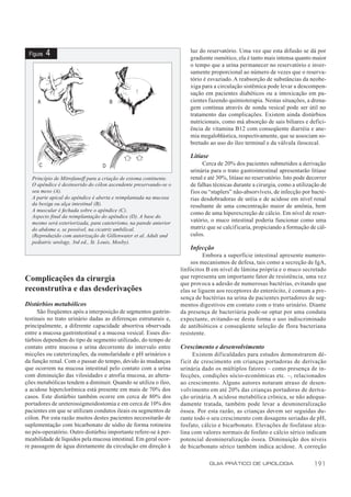 luz do reservatório. Uma vez que esta difusão se dá por
 Figura   4                                                             gradiente osmótico, ela é tanto mais intensa quanto maior
                                                                        o tempo que a urina permanecer no reservatório e inver-
                                                                        samente proporcional ao número de vezes que o reserva-
                                                                        tório é esvaziado. A reabsorção de substâncias da neobe-
                                                                        xiga para a circulação sistêmica pode levar a descompen-
                                                                        sação em pacientes diabéticos ou a intoxicação em pa-
                                                                        cientes fazendo quimioterapia. Nestas situações, a drena-
                                                                        gem contínua através de sonda vesical pode ser útil no
                                                                        tratamento das complicações. Existem ainda distúrbios
                                                                        nutricionais, como má absorção de sais biliares e defici-
                                                                        ência de vitamina B12 com conseqüente diarréia e ane-
                                                                        mia megaloblástica, respectivamente, que se associam so-
                                                                        bretudo ao uso do íleo terminal e da válvula ileocecal.

                                                                        Litíase
                                                                             Cerca de 20% dos pacientes submetidos a derivação
                                                                        urinária para o trato gastrointestinal apresentarão litíase
   Princípio de Mitrofanoff para a criação de estoma continente.        renal e até 30%, litíase no reservatório. Isto pode decorrer
   O apêndice é desinserido do cólon ascendente preservando-se o        de falhas técnicas durante a cirurgia, como a utilização de
   seu meso (A).                                                        fios ou “staplers” não-absorvíveis, de infecção por bacté-
   A parte apical do apêndice é aberta e reimplantada na mucosa         rias desdobradoras de uréia e de acidose em nível renal
   da bexiga ou alça intestinal (B).                                    resultante de uma concentração maior de amônia, bem
   A muscular é fechada sobre o apêndice (C).
                                                                        como de uma hiperexcreção de cálcio. Em nível de reser-
   Aspecto final da reimplantação do apêndice (D). A base do
   mesmo será exteriorizada, para cateterismo, na parede anterior
                                                                        vatório, o muco intestinal poderia funcionar como uma
   do abdome e, se possível, na cicatriz umbilical.                     matriz que se calcif icaria, propiciando a formação de cál-
   (Reproduzido com autorização de Gillenwater et al. Adult and         culos.
   pediatric urology, 3rd ed., St. Louis, Mosby).
                                                                        Infecção
                                                                              Embora a superfície intestinal apresente numero-
                                                                        sos mecanismos de defesa, tais como a secreção de IgA,
                                                                    linfócitos B em nível de lâmina própria e o muco secretado
Complicações da cirurgia                                            que representa um importante fator de resistência, uma vez
                                                                    que provoca a adesão de numerosas bactérias, evitando que
reconstrutiva e das desderivações                                   elas se liguem aos receptores do enterócito, é comum a pre-
                                                                    sença de bactérias na urina de pacientes portadores de seg-
Distúrbios metabólicos                                              mentos digestivos em contato com o trato urinário. Diante
      São freqüentes após a interposição de segmentos gastrin-      da presença de bacteriúria pode-se optar por uma conduta
testinais no trato urinário dadas as diferenças estruturais e,      expectante, evitando-se desta forma o uso indiscriminado
principalmente, a diferente capacidade absortiva observada          de antibióticos e conseqüente seleção de flora bacteriana
entre a mucosa gastrintestinal e a mucosa vesical. Esses dis-       resistente.
túrbios dependem do tipo de segmento utilizado, do tempo de
contato entre mucosa e urina decorrente do intervalo entre          Crescimento e desenvolvimento
micções ou cateterizações, da osmolaridade e pH urinários e                Existem dificuldades para estudos demonstrarem dé-
da função renal. Com o passar do tempo, devido às mudanças          f icit de crescimento em crianças portadoras de derivação
que ocorrem na mucosa intestinal pelo contato com a urina           urinária dado os múltiplos fatores – como presença de in-
com diminuição das vilosidades e atrofia mucosa, as altera-         fecções, condições sócio-econômicas etc. –, relacionados
ções metabólicas tendem a diminuir. Quando se utiliza o íleo,       ao crescimento. Alguns autores notaram atraso de desen-
a acidose hiperclorêmica está presente em mais de 70% dos           volvimento em até 20% das crianças portadoras de deriva-
casos. Este distúrbio também ocorre em cerca de 80% dos             ção urinária. A acidose metabólica crônica, se não adequa-
portadores de ureterossigmoidostomia e em cerca de 10% dos          damente tratada, também pode levar a desmineralização
pacientes em que se utilizam condutos ileais ou segmentos de        óssea. Por esta razão, as crianças devem ser seguidas du-
cólon. Por esta razão muitos destes pacientes necessitarão de       rante todo o seu crescimento com dosagens seriadas de pH,
suplementação com bicarbonato de sódio de forma rotineira           fosfato, cálcio e bicarbonato. Elevações de fosfatase alca-
no pós-operatório. Outro distúrbio importante refere-se à per-      lina com valores normais de fosfato e cálcio sérico indicam
meabilidade de líquidos pela mucosa intestinal. Em geral ocor-      potencial desmineralização óssea. Diminuição dos níveis
re passagem de água diretamente da circulação em direção à          de bicarbonato sérico também indica acidose. A correção

                                                                                  GUIA PRÁTICO DE UROLOGIA                    191
 