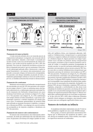 Figura   3                                                          Figura   4
    ESTRATÉGIA TERAPÊUTICA EM PACIENTES                                       ESTRATÉGIA TERAPÊUTICA EM
        COM SEMINOMA DO TESTÍCULO                                              PACIENTES COMTUMORES
                                                                           NÃO-SEMINOMATOSOS DOTESTÍCULO




                                                  (Srougi, 1995)


Tratamento                                                                                                            (Srougi, 1995)

                                                                    tidos sob vigilância clínica, sem tratamento adjuvante, indi-
Tratamento do tumor primário                                        cando-se linfadenectomia retroperitoneal ou quimioterapia
      A lesão testicular primária deve ser removida através de
                                                                    citotóxica se surgirem evidências de metástases retroperitoneais
orquiectomia realizada por via inguinal, com ressecção alta do
                                                                    ou a distância (figura 4). Alguns pacientes em estágio I apre-
cordão espermático. Quando a intervenção é executada por
                                                                    sentam riscos elevados de portarem doença retroperitoneal
incisão escrotal, existe risco de derramamento de células neo-
                                                                    microscópica, incluindo-se aqui os tumores primários com in-
plásicas, com recidiva local da neoplasia em 10% a 20% dos
                                                                    vasão do cordão, as neoplasias primárias acompanhadas de
pacientes. Nos casos de violação dos envoltórios escrotais im-
                                                                    invasão vascular, os casos de carcinoma embrionário puro e os
põe-se tratamento preventivo, que em seminomas é feito atra-
                                                                    pacientes com marcadores séricos iniciais acima de 500. Nes-
vés de radioterapia aplicada sobre o hemiescroto e região in-
                                                                    ses casos deve-se realizar linfadenectomia retroperitoneal, que
guinal homolateral, e em tumores não-seminomatosos com-
                                                                    demonstra a presença de metástases microscópicas em 40% a
preende a ressecção cirúrgica do hemiescroto correspondente.
                                                                    50% dos pacientes. Neoplasias em estágios IIb, IIc e III podem
Em pacientes com doença metastática já presente de início, o
                                                                    ser eficientemente controladas com quimioterapia citotóxica,
tratamento quimioterápico elimina os riscos de recidiva local e,
                                                                    que promove regressão completa das metástases em 60% a 95%
por isso, as medidas acima descritas tornam-se desnecessárias.
                                                                    dos casos. O esquema PEB (cisplatina, ectoposido e bleomici-
                                                                    na) é recomendado como tratamento de primeira linha, poden-
Tratamento dos seminomas                                            do-se recorrer às associações de ectoposido, ifosfamida e cis-
     Metástases microscópicas em linfonodos retroperitoneais        platina (VIP), de taxol, ifosfamida e cisplatina (TIP) ou de car-
são encontradas em cerca de 10% dos pacientes com semino-           boplatina, ectoposido e ciclofosfamida em altas doses (com
ma em estágio clínico I. Como os seminomas puros são bas-           transplante de medula) nos pacientes com doença de alto risco
tante radiossensíveis, a radioterapia representa a principal for-   (quadro 2) ou com persistência/progressão da neoplasia após o
ma de tratamento dos linfonodos retroperitoneais nos casos          emprego do esquema de primeira linha (figura 5). Massas resi-
de doença local mínima, que incluem os estágios I e II A (figu-     duais após a quimioterapia devem ser ressecadas cirurgicamen-
ra 3). Nos pacientes com estágios II b, IIc e III a radioterapia    te, já que cerca de 50% a 60% delas evidenciam elementos
nem sempre elimina as lesões metastáticas, o que torna a qui-       tumorais viáveis malignos ou benignos, cuja remoção contri-
mioterapia citotóxica o método terapêutico de eleição para          bui para curar um contingente significativo destes casos.
esses casos. O tratamento quimioterápico de primeira linha
mais utilizado no momento incorpora a cisplatina, o ectoposi-
do e a bleomicina (PEB), e seu emprego em casos de semino-          Tumores do testículo na infância
ma acompanha-se de respostas completas e duradouras em
95% dos pacientes.                                                        As neoplasias testiculares representam cerca de 1% dos tu-
                                                                    mores pediátricos, surgindo um caso a cada 100.000 crianças.
Tratamento dos tumores não-seminomatosos                                  Nesse grupo, os tumores apresentam características bio-
      Os tumores não-seminomatosos são relativamente radior-        lógicas que os diferenciam das neoplasias do adulto e, por
resistentes, de modo que radioterapia não está indicada nestes      isto, devem ser estudados à parte. Neste sentido, cinco aspec-
casos. Os pacientes com doença em estágio I podem ser man-          tos específicos merecem ser enfatizados:


198           GUIA PRÁTICO DE UROLOGIA
 