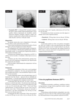 Figura   2                                                            Figura   3




     • Neonatal x HSV - A infecção HSV neonatal é um qua-             No neonato a dose é de 5 mg/dia, endovenosa, de 8 em 8 ho-
       dro grave e quase sempre requer hospitalização. Causa          ras, por sete dias.
       quadros clínicos importantes de encefalite, mielite                  O tratamento das lesões recorrentes tem tido algum re-
       transversa, hepatite, esofagite, cegueira e surdez. En-        sultado com os dois esquemas abaixo:
       tretanto, o quadro mais comum resulta em lesões ulce-
       radas da pele e da boca e infecção ocular.                         • Penciclovir: 250 mg, duas vezes ao dia por 120 dias;
                                                                          • Aciclovir: 200 mg, duas vezes ao dia por 180 dias.
Diagnóstico
     Na grande maioria das vezes o diagnóstico é feito pela           Prevenção
história clínica e pelo exame físico das lesões.                            A prevenção poderá ser feita com práticas monogâmi-
     Vários testes de laboratório foram preconizados a fim de         cas. Deve ser evitado o coito com parceiros(as) que tenham
distinguir as úlceras herpéticas de outras infecções.                 alguma lesão genital ou oral. É imprescindível o uso de pre-
     O citodiagnóstico de Tzanck poderá ajudar no diagnósti-          servativos nos coitos com parceiros que tenham história de
co e sua positividade é refletida pela multiplicação nuclear e        HSV Evitar o estresse emocional é um grande fator na pre-
                                                                           .
balonização celular. A coloração pelo Papanicolau permite a           venção de lesões recorrentes.
observação de inclusões virais.
     O método mais fidedigno para o diagnóstico do HSV é a                                      RESUMO
cultura viral em tecidos: o resultado é observado em um ou
dois dias.                                                                             CONTATO SEXUAL OU NÃO
     A biópsia, que não é feita rotineiramente, permite esta-
belecer com certa segurança o diagnóstico por identificação                          Vesículas ou úlceras rasas genitais
dos corpúsculos de inclusão.
     Está em estudo a determinação do componente viral em                               História clínica de repetição
“swab” da lesão.
                                                                                               Cultura viral?
Tratamento
     O tratamento sintomático é feito com o uso de qualquer
antiinflamatório e analgésico. Às vezes, por apresentar infec-                                      HSV
ção secundária das lesões, o uso de antibiótico tópico ou sistê-
mico se faz necessário.                                                                         Tratamento?
     É muito importante manter a área infectada limpa e seca. O
tratamento local das úlceras – apesar de não ser admitido por
alguns autores – e o uso de cremes antivirais, do tipo aciclovir ou
penciclovir, têm importante fator analgésico nestas lesões.           Vírus do papiloma humano (HPV)
     A lesão pelo HSV não tem cura. Às vezes, o que conse-
guimos é o controle das lesões. Os antivirais mais usados são         Sinonímia
o aciclovir e o penciclovir. O aciclovir foi descoberto em 1982            Condiloma acuminado, condiloma, condiloma venéreo,
e seu uso foi autorizado pelo “FDA - Food and Drug                    verruga peniana, verruga venérea, papiloma venéreo, vegeta-
Administration”, na dose de 200 mg via oral, cinco vezes ao           ções venéreas, crista de galo.
dia por cinco dias. Ultimamente, entrou no mercado o
penciclovir e sua dose recomendada é de 250 mg via oral,              Etiologia
duas vezes ao dia por cinco dias.                                          É uma doença conhecida desde a antiguidade, mas a des-
     O tratamento do HSV na gravidez é feito com aciclovir            coberta do vírus só se deu em 1930, sendo que apenas a partir
na dose de 200 mg via oral, cinco vezes ao dia por dez dias.          de 1980 transformou-se num problema expressivo de DST.

                                                                                    GUIA PRÁTICO DE UROLOGIA                 227
 